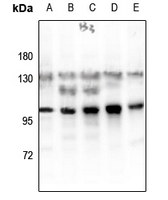 1 - Anti-Glucocorticoid Receptor (Phospho-S203) Antibody AP61259