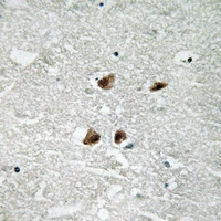 19 - Anti-HSF1 (Phospho-S121) Antibody AP61260