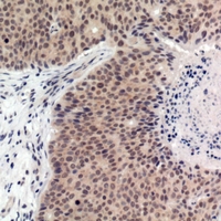 19 - Anti-p53 (Phospho-T387) Antibody AP61261