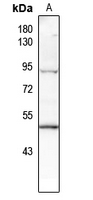 1 - Anti-p53 (Phospho-T387) Antibody AP61261