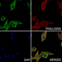 3 - Anti-PDGFR beta (Phospho-Y771) Antibody AP61262