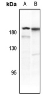 1 - Anti-PDGFR beta (Phospho-Y771) Antibody AP61262