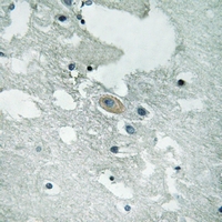 19 - Anti-BLNK (Phospho-Y84) Antibody AP61264