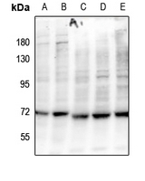 1 - Anti-BLNK (Phospho-Y84) Antibody AP61264