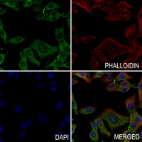 3 - Anti-Paxillin (Phospho-S272) Antibody AP61265