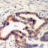 19 - Anti-Paxillin (Phospho-S272) Antibody AP61265