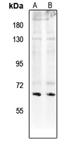 1 - Anti-Paxillin (Phospho-S272) Antibody AP61265