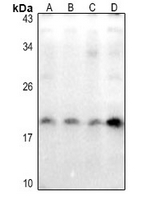 1 - Anti-Caveolin 2 (Phospho-Y27) Antibody AP61266