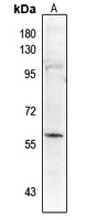 1 - Anti-PALF (Phospho-S116) Antibody AP61267