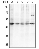 1 - Anti-C/EBP alpha (Phospho-T230) Antibody AP61268
