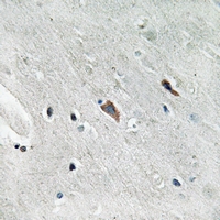 19 - Anti-GAB2 (Phospho-Y643) Antibody AP61269