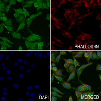 3 - Anti-MK2 (Phospho-S272) Antibody AP61271