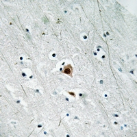 19 - Anti-MK2 (Phospho-S272) Antibody AP61271