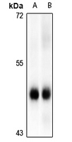 1 - Anti-MK2 (Phospho-S272) Antibody AP61271