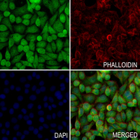 3 - Anti-NFAT3 (Phospho-S168/S170) Antibody AP61272