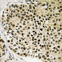 19 - Anti-NFAT3 (Phospho-S168/S170) Antibody AP61272
