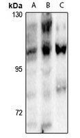 1 - Anti-NFAT3 (Phospho-S168/S170) Antibody AP61272