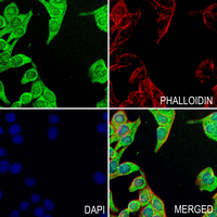 3 - Anti-Presenilin 1 (Phospho-S357) Antibody AP61273