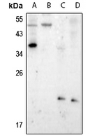1 - Anti-Presenilin 1 (Phospho-S357) Antibody AP61273