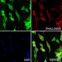 3 - Anti-NCOA1 (Phospho-T1179) Antibody AP61274