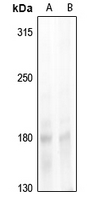 1 - Anti-NCOA1 (Phospho-T1179) Antibody AP61274