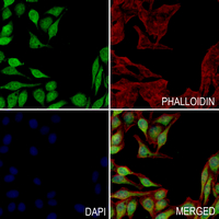 3 - Anti-RRN3 (Phospho-S649) Antibody AP61275