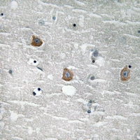 19 - Anti-TOB (Phospho-S164) Antibody AP61276