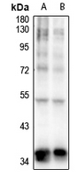 1 - Anti-TOB (Phospho-S164) Antibody AP61276