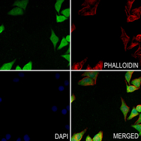 3 - Anti-FHIT (Phospho-Y114) Antibody AP61277