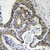 19 - Anti-FHIT (Phospho-Y114) Antibody AP61277