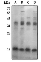 1 - Anti-FHIT (Phospho-Y114) Antibody AP61277