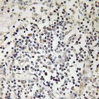 19 - Anti-Lamin A/C (Phospho-S22) Antibody AP61278