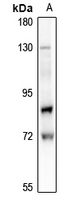 1 - Anti-Lamin A/C (Phospho-S22) Antibody AP61278