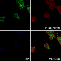 3 - Anti-LRP6 (Phospho-T1479) Antibody AP61279