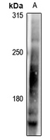 1 - Anti-LRP6 (Phospho-T1479) Antibody AP61279