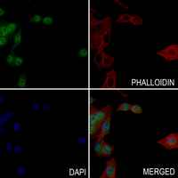 3 - Anti-Focal Adhesion Kinase (Phospho-S722) Antibody AP61280