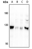 1 - Anti-Focal Adhesion Kinase (Phospho-S722) Antibody AP61280