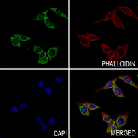 3 - Anti-GABBR2 (Phospho-S893) Antibody AP61281