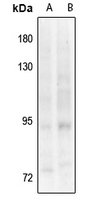 1 - Anti-TRK B (Phospho-Y817) Antibody AP61283