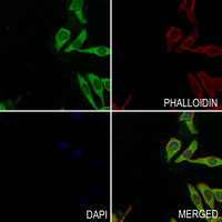 3 - Anti-FGFR4 (Phospho-Y642) Antibody AP61285
