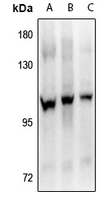 1 - Anti-FGFR4 (Phospho-Y642) Antibody AP61285