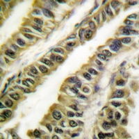 19 - Anti-ABL1/2 Antibody AP61287