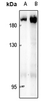 1 - Anti-ABL1/2 Antibody AP61287