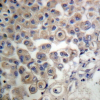 19 - Anti-PLC beta 3 Antibody AP61288