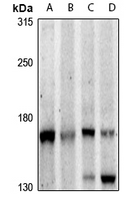 1 - Anti-PLC beta 3 Antibody AP61288