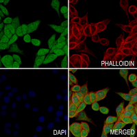 3 - Anti-DAP Kinase 3 Antibody AP61290