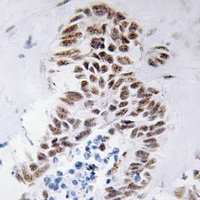19 - Anti-DAP Kinase 3 Antibody AP61290