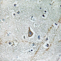 19 - Anti-GNAZ Antibody AP61291