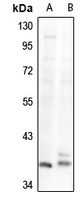 1 - Anti-GNAZ Antibody AP61291