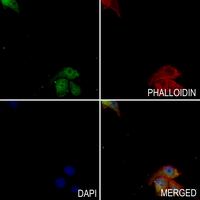 3 - Anti-IRAK1 Antibody AP61292